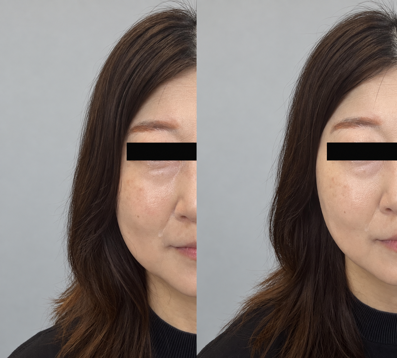 50代女性のフェイスライン 使用前と片側5プッシュ30秒後の比較写真