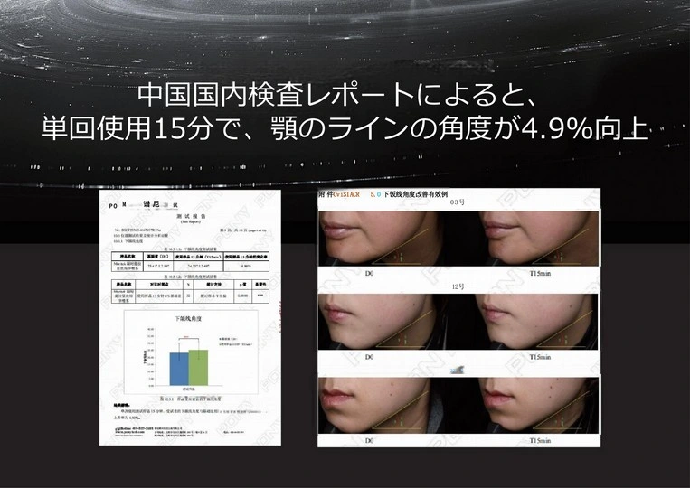単回使用後の試験関連資料